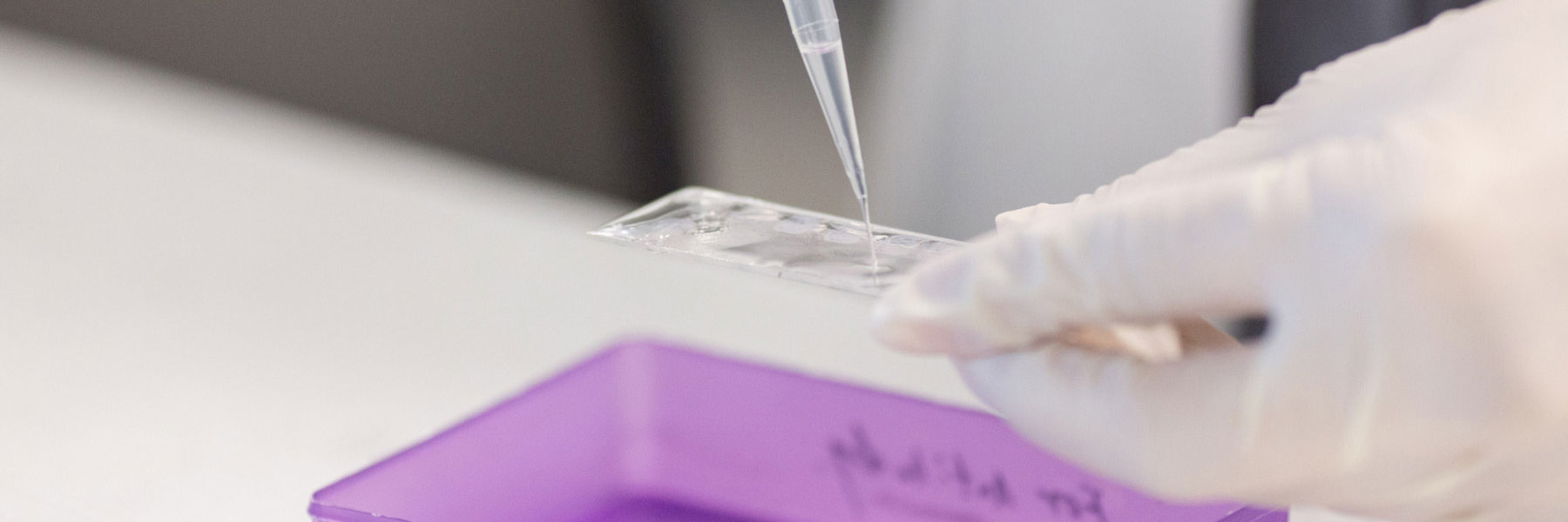 A person prepares a microscope slide by adding liquid from an automatic pipette.